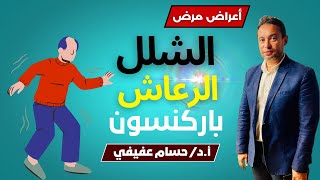 أعراض الشلل الرعاش المبكرة \