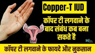 Copper-T🤔IUD Lagwane ke kitne din baad Sambandh Banana Chahiye.Copper T लगने के बाद कब साथ में रहे.