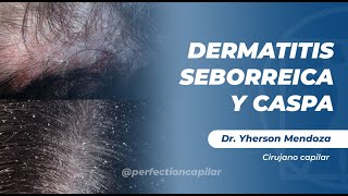 Dr. Yherson Mendoza: Dermatitis seborreica y caspa