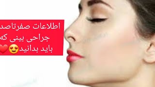 جراحی بینی گوشتی واستخوانی/تفاوت جراحی بازوبسته/تفاوت رینوپلاستی وسپتوپلاستی/عوارض ومزایای جراحی❤