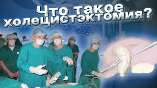 Что такое холецистэктомия?