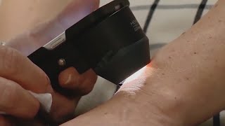 Skin Cancer Rates Are Higher In Colorado Because We Have A Higher UV Index