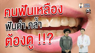 ต้องดู!! วิธีแก้ปัญหา ฟันเหลือง ฟันดำ ฟันคล้ำ ? | ลิ้นติดโปร By หมอโชค