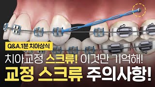 치아교정 스크류 통증, 붓기, 염증, 양치 등 미니스크류 주의사항!? ⏰1분 치아상식 꿀팁!!