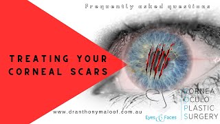 FAQ - Treating your corneal scars with Dr Anthony Maloof, Sydney