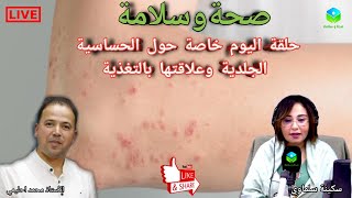 🔴 حلقة اليوم خاصة حول الحساسية الجلدية وعلاقتها بالتغذية مع الأستاذ محمد احليمي اخصائي تغذية صحية