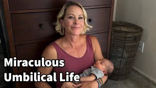 196 - Miraculous Umbilical Life