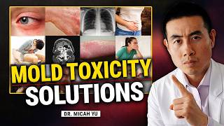 5 Steps To Treat Mold Toxicity and Mycotoxins