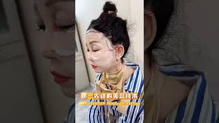 #整形 #医美 #大拉皮 #facelift #拉皮