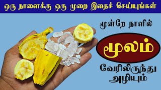 இது பைல்ஸ் என்னும் மூல நோயை வேரோடு அறுக்கும் | piles home remedy tamil