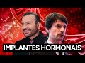 Implantes Hormonais - Mitos, Dúvidas e Informação Precisa [Análise crítica sobre implante hormonal]