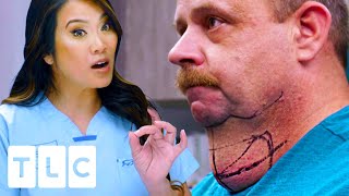 Man’s SMOTHERING Throat Lump Gets Removed After 20 YEARS | Dr. Pimple Popper
