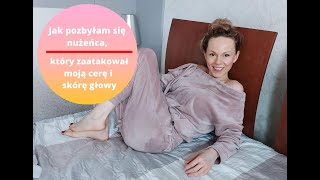 Jak pozbyłam się nużeńca?