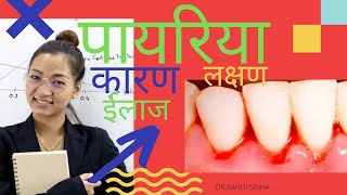 # पायरिया,पायरिया का कारण, # पायरिया का  ईलाज,#पायरिया का लक्षण,# pyorrhea,periodontitis,bleedingum