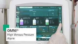 OMNI®: High Venous Pressure Alarm