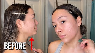 Trying Gua Sha for 1 Week! BEFORE & AFTER RESUTLS