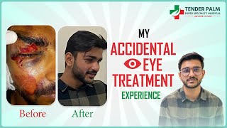 My Accidental Eye Treatment in Tender Palm Hospital #accidental #treatments