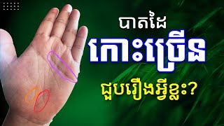 #137K បាតដៃ ដែលមានកោះច្រើនបែបនេះ តើអាចជួបរឿងអ្វីខ្លះក្នុងជីវិត | អ្នកគ្រូគីម