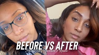 MICROSHADING VS MICROBLADING | MY EXPERIENCE & HEALING PROCESS