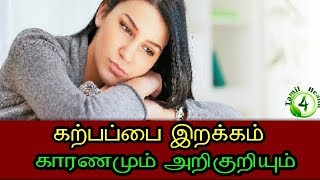 கற்பப்பை இறக்கம் காரணமும் அறிகுறிகளும்  (uterus removal in tamil )