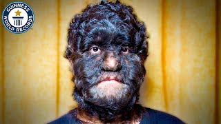 The World's Hairiest Family | Records Weekly - Guinness World Records