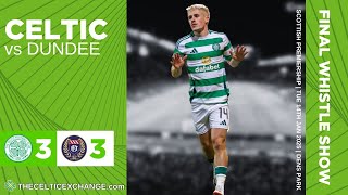 Celtic In 3-3 Thriller At Dens | A Cause For Concern Ahead Of Upcoming Clashes?