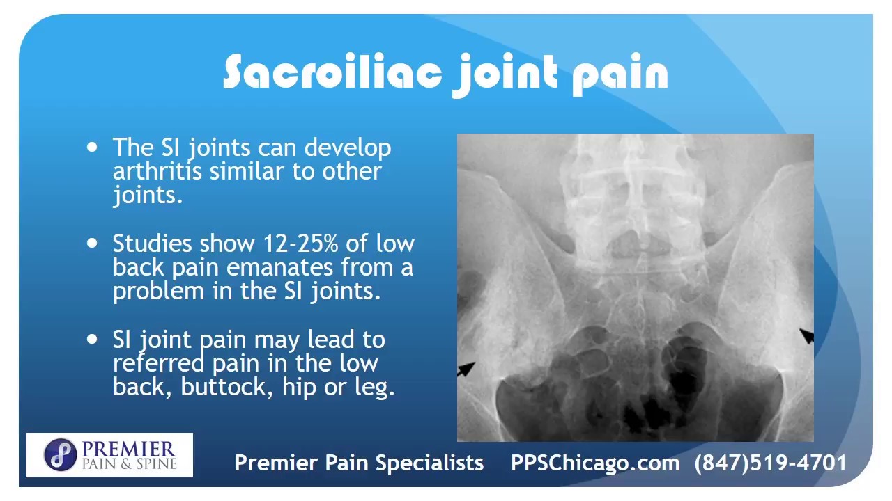 SI Joint Injection Explained By A Top Chicago Pain Management Center ...