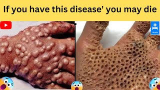 If you have this types of disease' you may be die | most dangerous disease in the world |
