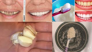 Как отбелить зубы за 4 минуты/how to whiten teeth in 4 minutes/ինչպես սպիտակեցնել ատամները 4 րոպեում