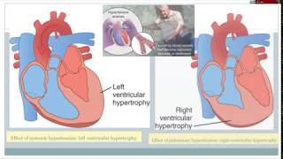 Pathophysiology- The Heart (Ch. 8)