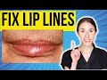 Top Tips To Fix Lip Lines