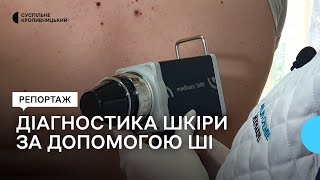 У Кропивницькому  новоутворення й хвороби шкіри діагностують за допомогою штучного інтелекту