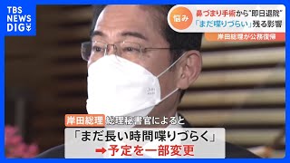 岸田総理が鼻づまり手術の全身麻酔から“即日退院”　秘書官「まだ長時間しゃべりづらい」政府関係者「早く戻らなきゃという強い意志」｜TBS NEWS DIG