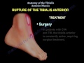 anatomy of the tibialis anterior muscle everything you need to know dr. nabil ebraheim