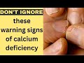 Symptoms of Calcium Deficiency,Don't ignore these warning signs of calcium deficiency