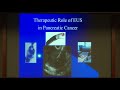 advanced endoscopic management techniques for pancreatic malignancy