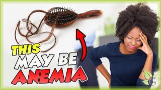 How Anemia causes Hair Loss - The Science behind it