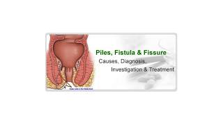 Piles Fistula \u0026 fissure in ano