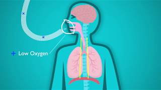 Intermittent Hypoxia July 6