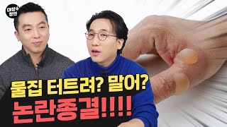 물집 이거 터트려, 말어!!!! 어떻게 해야돼 !!!