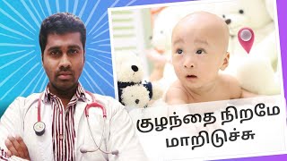 உங்கள் குழந்தை கலராக மாற baby color improve tips