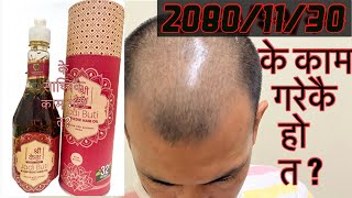 AYURVEDIC HAIR OIL SHREE KESH  first experience श्री केश तेल