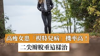 高瘦女患「模特兒病」機率高！　二尖瓣脫垂這樣治