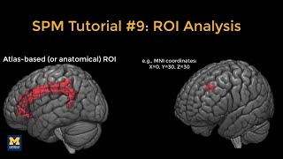 SPM Tutorial #9: ROI Analysis