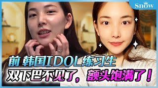 前韓國IDOL練習生! 雙下巴吸脂+額頭脂肪填充 VLOG💕