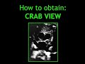 How to obtain: CRAB VIEW (Paediatric Echocardiography)!