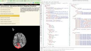Exploring Public Biomedical Datasets: EEG Data, Metadata Issues & Open Source Tools | BioniChaos
