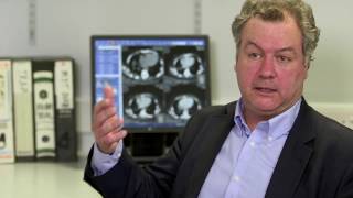 How does Asbestos cause Mesothelioma? | Leigh Day Industrial Disease Lawyers