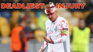 The most DEADLIEST head injury in football [Domagoj Vida ]
