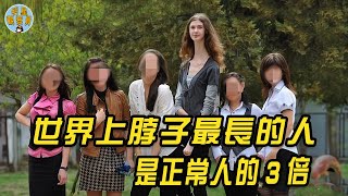 現實中的橡膠人？身高2米體重卻只有47公斤，脖子是正常人的3倍長 ｜世界最長脖子｜明星觀察員